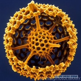 Images/Micropaleont/Radiolaria2.jpg